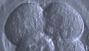 Read more about the article Embryo donation – skal det tillades i Danmark?